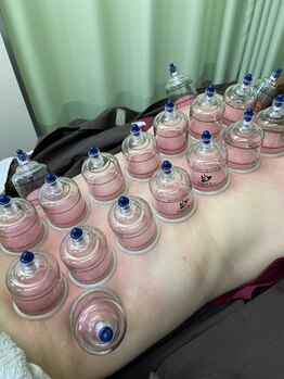 アキュピタル(acupital)/大人気