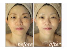 アン グレーヌ 自由が丘(unegraine)/エイジングケアで若々しく！