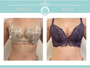 美人バスト 千早店/バストアップ◇育乳症例◇