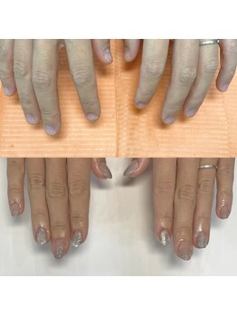 ハッカネイル(HAKKA NAIL)/