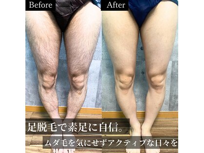 ラフ(LaFF)の写真