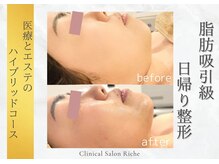 リッシュ 神戸岡本院(RICHE)の雰囲気（本気のたるみケア、小顔造形/看護師サロンだからできる本格技術）