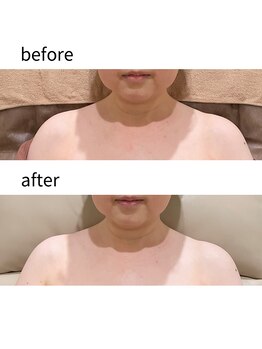 シエル(Ciel)/首肩周りもスッキリ