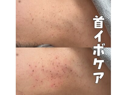 プライベートサロン プース(pousse)の写真