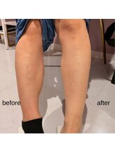 ファロンビューティー(fallon beauty)/お客様ビフォー×アフター