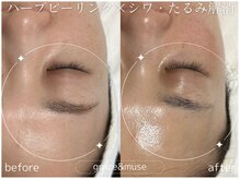 グレイス アンド ミューズ(grace&muse)/クリスティーナ/カスタムエステ