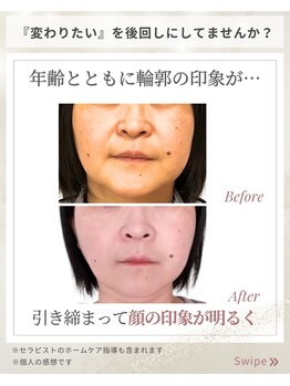 アロハ(ALOHA.)/その悩み、本当に"年齢のせい"?