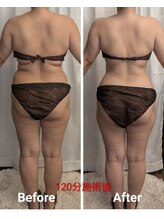 フィニシオン/40代120分施術　ウエストくびれ