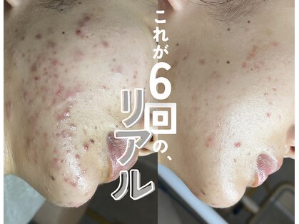 ソアスキン(SOAskin)の写真