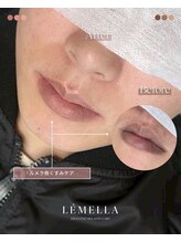 エルビービュティーサロン(LB BEAUTY SALON)/【ルメラ乳輪】実績数関西1★