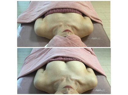 エリマ(elima)の写真