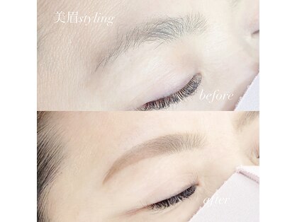 アトラクト(Attract)の写真