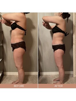 リファラ 光の森店(REFALA)/【痩身/30代女性】約3ヶ月の結果