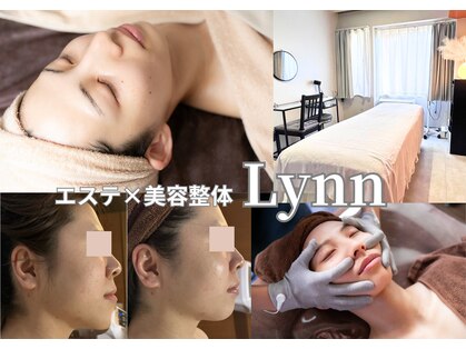 リン(Lynn)の写真