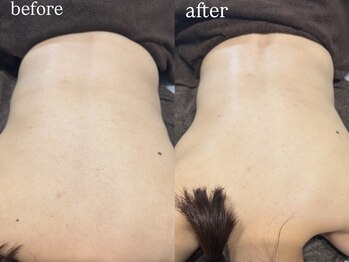 ビビ(Vivi)/背中美人で最高の花嫁に♪