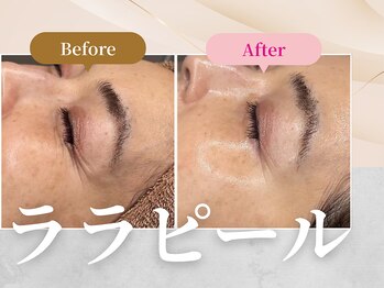 フェルナ 上新庄店(FERNA)/ララピール