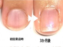 ブリエネイルの雰囲気（30代/女性/会社員/施術の効果には個人差があります）
