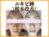  良くならない大人！肌が本来持つ「再生力」と「自己修復力」を引き出します