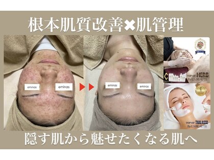 エミナス(EMINAS)の写真