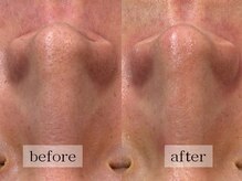 グランビューティ(Glanz Beauty)/30代男性