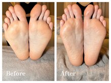 ジプソフィリア(gypsophila)の雰囲気（プロの角質ケアでツルふわの足裏へ。ご相談ください。）