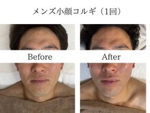 サロン ル プレジール(Salon le Plaisir)/小顔コルギ