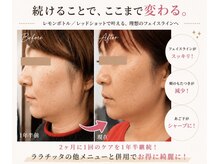 ララチッタ(L’la citta)