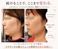 ララチッタ(L’la citta)