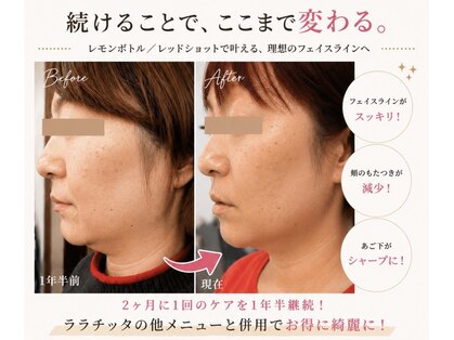 ララチッタ(L’la citta)の写真