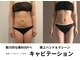 トータルビューティーサロンリア(Li'a)の写真