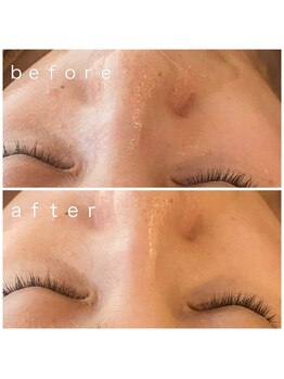 メナードフェイシャルサロン 岐阜茜部/贅沢コラーゲンパック