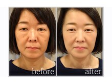 アン グレーヌ 自由が丘(unegraine)/若々しく健康的な印象に！