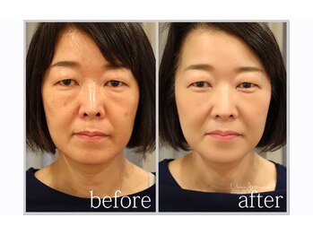 アン グレーヌ 自由が丘(unegraine)/若々しく健康的な印象に！