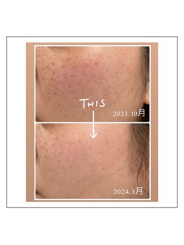 リオル(Rior)/韓国艶肌光ケア