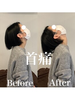 整骨院 整体院 ユールーム 周南支店(YOUROOM)/【首痛】【首こり】