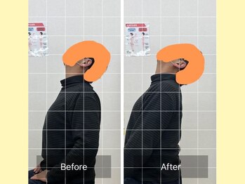 ナオル整体 春日部院(NAORU整体)/首の詰まり解消