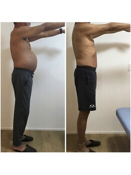 平川鍼灸接骨院 小堀院/腸内改善