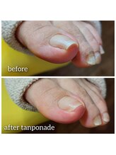 爪切り屋 足楽/