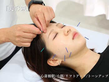 アロエ鍼灸整体院/美容鍼/しわ/たるみ/小顔