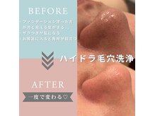 ロザリア(ROSALIA)/話題のハイドラ毛穴洗浄！