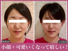 アクアビー(AQUA-B)/