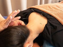 歩鍼灸院整骨院の雰囲気（めまいや耳鳴りなどにお悩みの方は是非お試しください！）