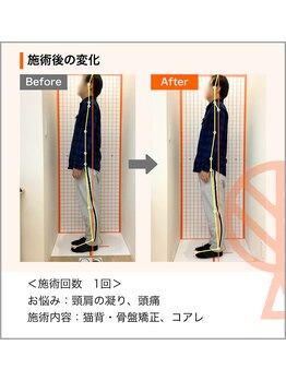 ただき接骨院 整体院 高関院/お悩み：頸肩の凝り、頭痛