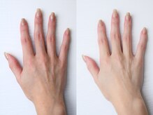 ジーナ(GINA)/ハンドエステ