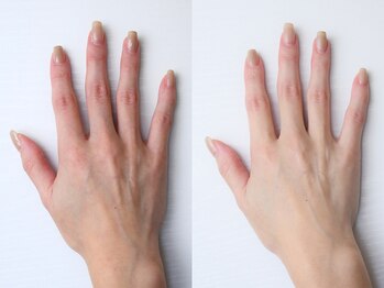 ジーナ(GINA)/ハンドエステ