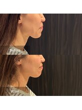 プライミー(PRIMY)/横顔美人！首の長さ激変