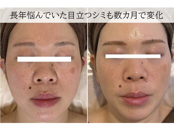 ラグランシエル(Le grand ciel)/生活習慣を変えれなくても。。。