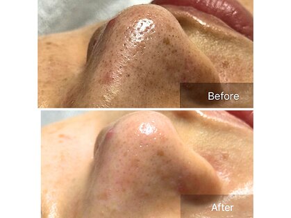 ラルム(Larme)の写真