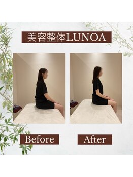 美容整体LUNOA　神戸三宮院/[三ノ宮/美容整体/整体/肩こり]