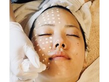 サロン モナ(Salon Mona)の雰囲気(知多半島初上陸、今話題のメソスキンカラー)
